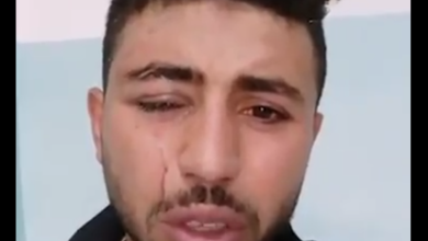 فقأ عين العامل المصري محمود الزغبي في الأردن watan.com