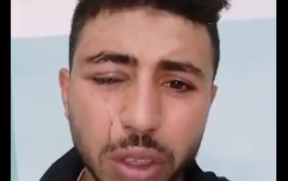 فقأ عين العامل المصري محمود الزغبي في الأردن watan.com