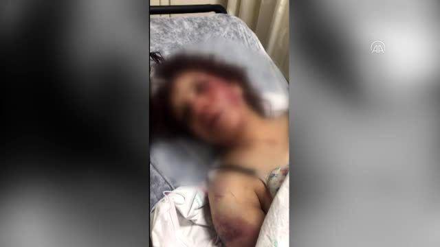 في بلد السعادة عذب زوجته وحرقها.. صورة من الأرشيف watan.com